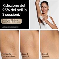 LUCE PULSATA EPILAT.IPL PL52