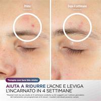 CRYOGLOW MASCHERA VISO LED